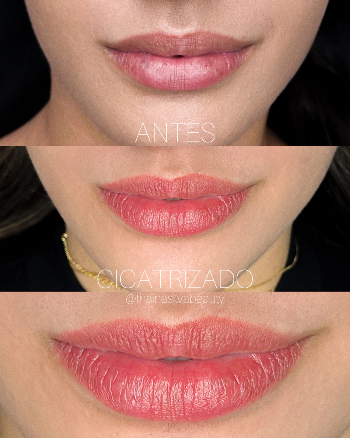 Antes e depois de micropigmentação labial